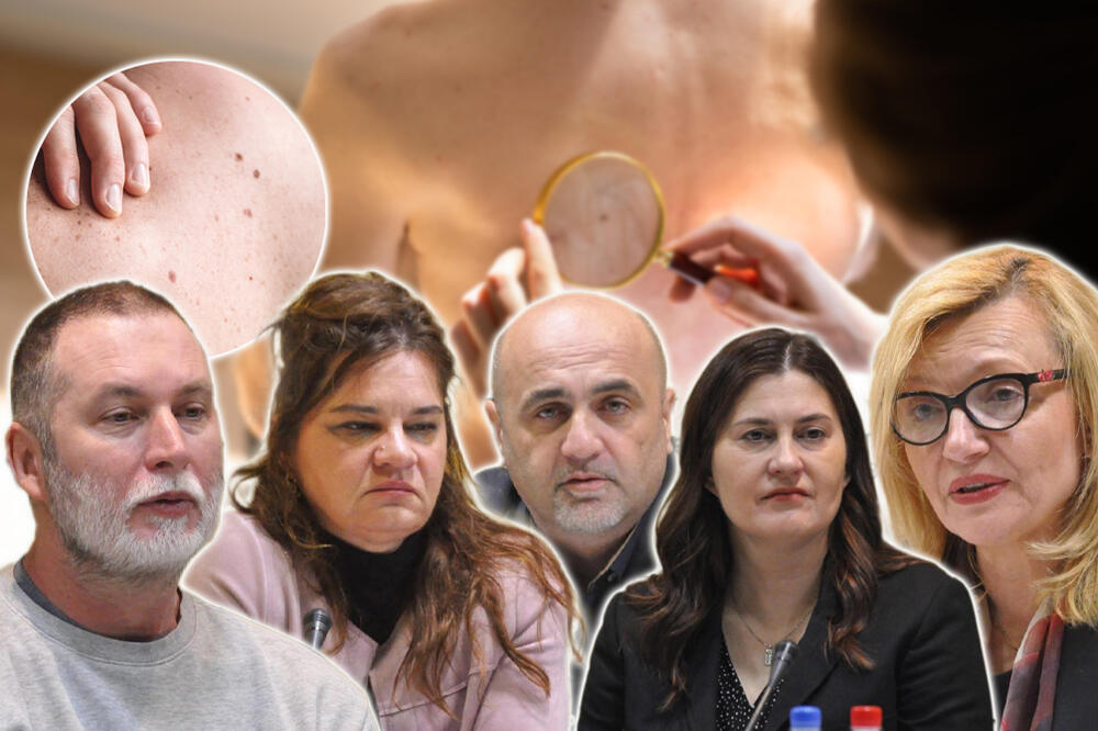 MELANOM JE NAJOPASNIJI RAK KOŽE: Može se naći i u OVOM organu, struka ...