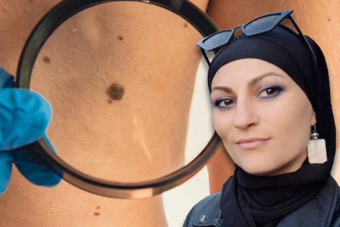 Afroditin put od melanoma do izlečenja: Mislila sam da je kraj, da neću biti uz ćerku dok odrasta, a sada želim da što više ljudi čuje moju poruku
